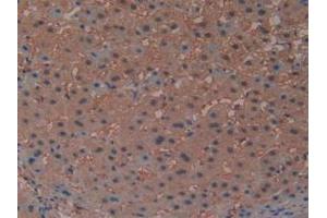 Detection of PTGDS in Human Liver Tissue using Polyclonal Antibody to Prostaglandin-H2 D-isomerase (PTGDS)