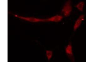 ABIN6274852 staining HeLa cells by IF/ICC.