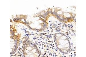 Immunohistochemistry analysis of paraffin-embedded human colon using,CFA (ABIN7076044) at dilution of 1: 300 (TBCA anticorps)