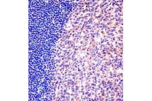 Immunohistochemistry analysis in formalin fixed and paraffin embedded human tonsil tissue reacted with MCM6 Antibody (N-term) followed which was peroxidase conjugated to the secondary antibody and followed by DAB staining. (MCM6 anticorps  (N-Term))