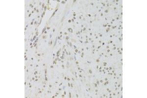 Immunohistochemistry of paraffin-embedded human leiomyoma of uterus using RUVBL1 Antibody. (RUVBL1 anticorps  (AA 1-240))