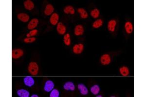 Confocal immunofluorescence analysis of HeLa cells using DNMT1 Polyclonal Antibody at dilution of 1:100.