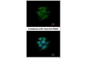 ICC/IF Image Immunofluorescence analysis of methanol-fixed MCF-7, using JNK2, antibody at 1:200 dilution. (JNK2 anticorps)