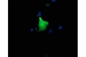 Image no. 2 for anti-Kinesin Family Member 25 (KIF25) antibody (ABIN1499039)