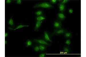 Immunofluorescence of monoclonal antibody to AKR1B10 on HeLa cell. (AKR1B10 anticorps  (AA 76-143))