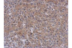 IHC-P Image Immunohistochemical analysis of paraffin-embedded RT2 xenograft, using Radixin, antibody at 1:500 dilution.