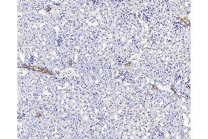 Immunohistochemistry (antigen was repair with 0.