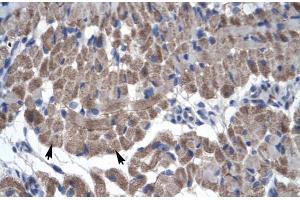 Rabbit Anti-GAS7 Antibody Catalog Number: ARP30004 Paraffin Embedded Tissue: Human Muscle Cellular Data: Skeletal muscle cells Antibody Concentration: 4.