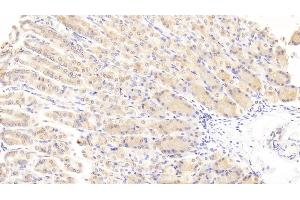 Detection of WISP1 in Mouse Stomach Tissue using Polyclonal Antibody to WNT1 Inducible Signaling Pathway Protein 1 (WISP1)