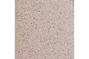 IHC analysis of Septin 11/SEPTIN11 using anti-Septin 11/SEPTIN11 antibody (ABIN7602925). (Septin 11 anticorps  (C-Term))