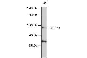Western blot analysis of extracts of Raji cells, using SPHK2 antibody (ABIN6128746, ABIN6148347, ABIN6148348 and ABIN6222478) at 1:1000 dilution. (SPHK2 anticorps  (AA 1-165))