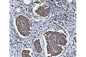 IHC analysis of SIRT5 using anti-SIRT5 antibody (ABIN7602524). (SIRT5 anticorps  (AA 81-310))