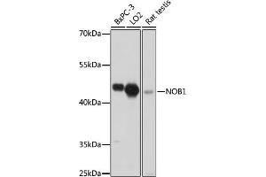 Western blot analysis of extracts of various cell lines, using NOB1 antibody (ABIN7270109) at 1:1000 dilution. (NOB1 anticorps  (AA 1-230))