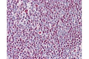 Anti-IKZF3 / AIOLOS antibody IHC of human tonsil.