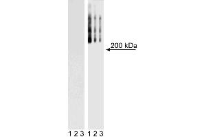 Western Blot analysis of TRA-1-60 in mouse and human ES cell lines. (TRA1-81 anticorps)