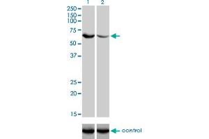 Western blot analysis of UGP2 over-expressed 293 cell line, cotransfected with UGP2 Validated Chimera RNAi (Lane 2) or non-transfected control (Lane 1).