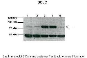 Lanes:  1: 40ug mouse heart lysate, 2: 40ug mouse heart lysate, 3: 40ug mouse heart lysate, 4: 40ug mouse heart lysate, 5: 40ug mouse heart lysate Primary Antibody Dilution:  1:1000 Secondary Antibody:  Anti-rabbit HRP Secondary Antibody Dilution:  1:10000 Gene Name:  GCLC Submitted by:  Anonymous