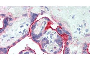 Immunohistochemistry of paraffin-embedded Human Placenta using NECTIN4 Polyclonal Antibody at dilution of 1:90.