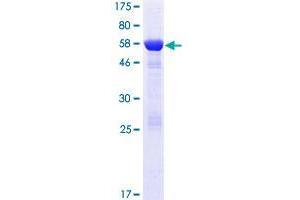 Image no. 1 for DCN1, Defective in Cullin Neddylation 1, Domain Containing 3 (DCUN1D3) (AA 1-304) protein (GST tag) (ABIN1351239)