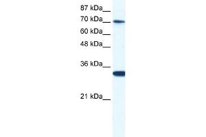 WB Suggested Anti-CNOT3 Antibody Titration:  0. (CNOT3 anticorps  (N-Term))