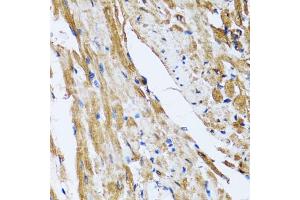 Immunohistochemistry of paraffin-embedded rat heart using GOLM1 antibody (ABIN5974385) at dilution of 1/100 (40x lens). (GOLM1 anticorps)