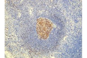 Immunohistochemistry (IHC) image for anti-Fc Fragment of IgE, Low Affinity II, Receptor For (CD23) (FCER2) (AA 295-320), (C-Term) antibody (ABIN7598826)