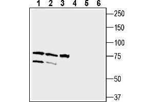 Western blot analysis of human  neuroblastoma cell line lysate (lanes 1 and 4), human  retinal epithelial cell line lysate (lanes 2 and 5) and human LNCaP prostate carcinoma cell line lysate (lanes 3 and 6):1-3.