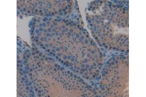 anti-Interleukin 3 (IL-3) (AA 33-166) antibody