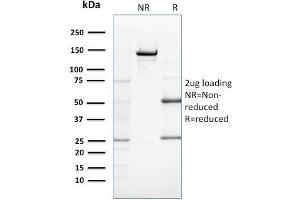 SDS-PAGE Analysis Purified ZNF690 / ZSCAN29 Mouse Monoclonal Antibody (ZSCAN29/2610). (ZSCAN29 anticorps)
