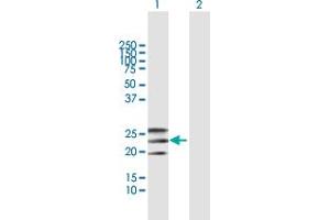 Western Blot analysis of EFNA2 expression in transfected 293T cell line by EFNA2 MaxPab polyclonal antibody.