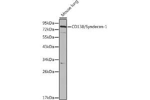 Western blot analysis of extracts of Mouse lung cells, using CD138/Syndecan-1 antibody (ABIN3021804, ABIN3021805, ABIN3021806 and ABIN6215950) at 1:1000 dilution. (Syndecan 1 anticorps  (AA 25-240))