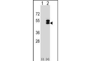 Western blot analysis of ATXN3 (arrow) using rabbit polyclonal ATXN3 Antibody (Center) (ABIN653191 and ABIN2842741). (Ataxin 3 anticorps  (AA 261-288))