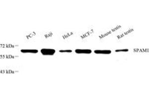 Western blot analysis of SPAM1 (ABIN7075699),at dilution of 1: 600 (SPAM1 anticorps)