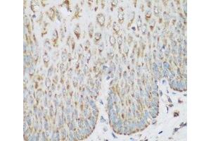 Immunohistochemistry of paraffin-embedded Human esophagus using IGF2BP3 Polyclonal Antibody at dilution of 1:200 (40x lens). (IGF2BP3 anticorps)