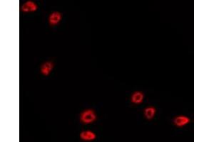 ABIN6267289 staining MDA-MB-435 by IF/ICC.