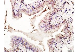 Paraformaldehyde-fixed, paraffin embedded rat bladder tissue, Antigen retrieval by boiling in sodium citrate buffer(pH6) for 15min, Block endogenous peroxidase by 3% hydrogen peroxide for 30 minutes, Blocking buffer (normal goat serum) at 37°C for 20min, Antibody incubation with Rabbit Anti-p53 (FL-393) Polyclonal Antibody, Unconjugated  at 1:400 overnight at 4°C, followed by a conjugated secondary and DAB staining