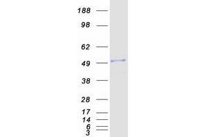 Validation with Western Blot