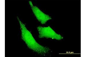 Immunofluorescence of monoclonal antibody to RNF111 on HeLa cell.