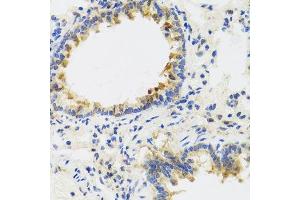 Immunohistochemistry of paraffin-embedded rat lung using UVRAG antibody.