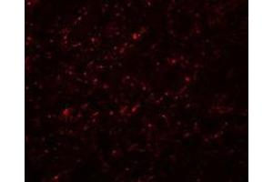 Immunofluorescence of GRB10 in rat brain cells with GRB10 Antibody   at 20 µg/ml.