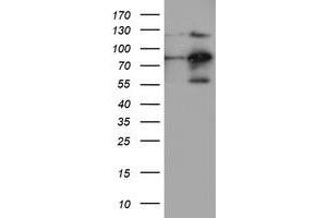 Western Blotting (WB) image for anti-Folate Hydrolase (Prostate-Specific Membrane Antigen) 1 (FOLH1) antibody (ABIN1500454) (PSMA anticorps)