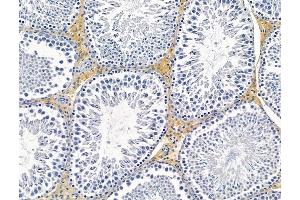 anti-Family with Sequence Similarity 159, Member B (FAM159B) antibody