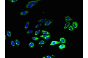 Immunofluorescent analysis of HepG2 cells using ABIN7170271 at dilution of 1:100 and Alexa Fluor 488-congugated AffiniPure Goat Anti-Rabbit IgG(H+L)