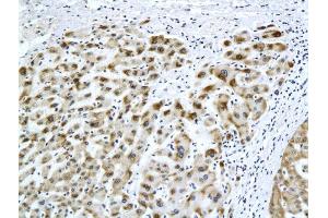 Formalin-fixed and paraffin embedded rat liver labeled with Anti-HBsAg(H2F4) Monoclonal Antibody, Unconjugated (bsm-2024M) at 1:200 followed by conjugation to the secondary antibody and DAB staining