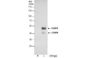 IP Image Immunoprecipitation of CEBPB protein from HeLa nuclear extracts using 5 μg of C/EBP beta antibody, Western blot analysis was performed using C/EBP beta antibody, EasyBlot anti-Rabbit IgG  was used as a secondary reagent. (CEBPB anticorps  (N-Term))