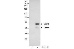 IP Image Immunoprecipitation of CEBPB protein from HeLa nuclear extracts using 5 μg of C/EBP beta antibody, Western blot analysis was performed using C/EBP beta antibody, EasyBlot anti-Rabbit IgG  was used as a secondary reagent.