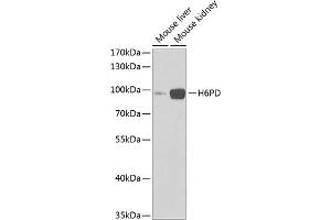 Western blot analysis of extracts of various cell lines, using H6PD Antibody (ABIN6131015, ABIN6141581, ABIN6141582 and ABIN6222086) at 1:1000 dilution. (Glucose-6-Phosphate Dehydrogenase anticorps  (AA 20-200))