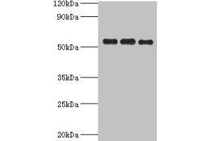 Western blot All lanes: PDHX antibody at 6 μg/mL Lane 1: 293T whole cell lysate Lane 2: PC-3 whole cell lysate Lane 3: MCF-7 whole cell lysate Secondary Goat polyclonal to rabbit IgG at 1/10000 dilution Predicted band size: 55, 30, 52 kDa Observed band size: 55 kDa (PDHX anticorps  (AA 1-300))