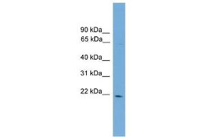 Human COLO205; WB Suggested Anti-D4S234E Antibody Titration: 0. (NSG1 anticorps  (N-Term))