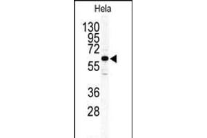 Western blot analysis of anti-ILK2/ILK1 Antibody (C-term) (ABIN391105 and ABIN2837942) in Hela cell line lysates (35 μg/lane). (ILK anticorps  (C-Term))
